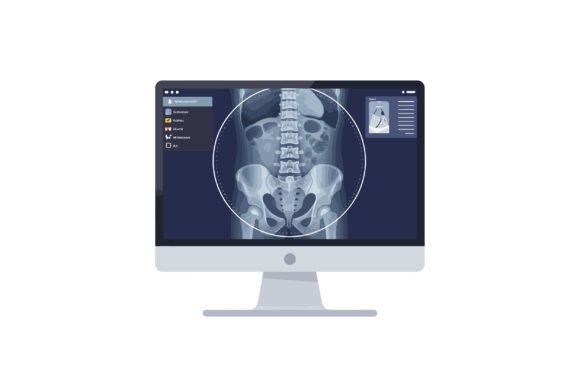 Digital Illustration of an X-ray Display for Graphics